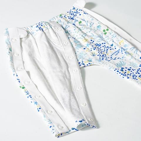 お直し事例1 両脇をフルオープン