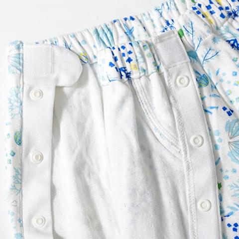 お直し事例1 両脇をフルオープン